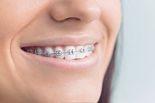 Best Dentures (Full and Partial)  in La Porte, TX