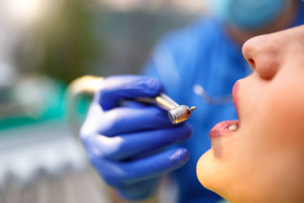 Dental Bonding in La Porte, TX